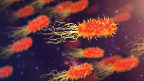 Mayo man in ICU as his wife dies in deadly botulism outbreak in France