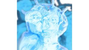 Castle walls, tall grass and an Understory