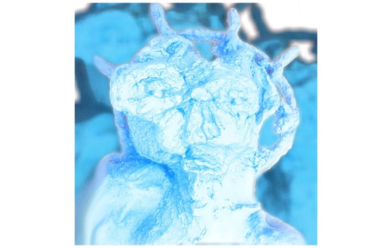 Castle walls, tall grass and an Understory